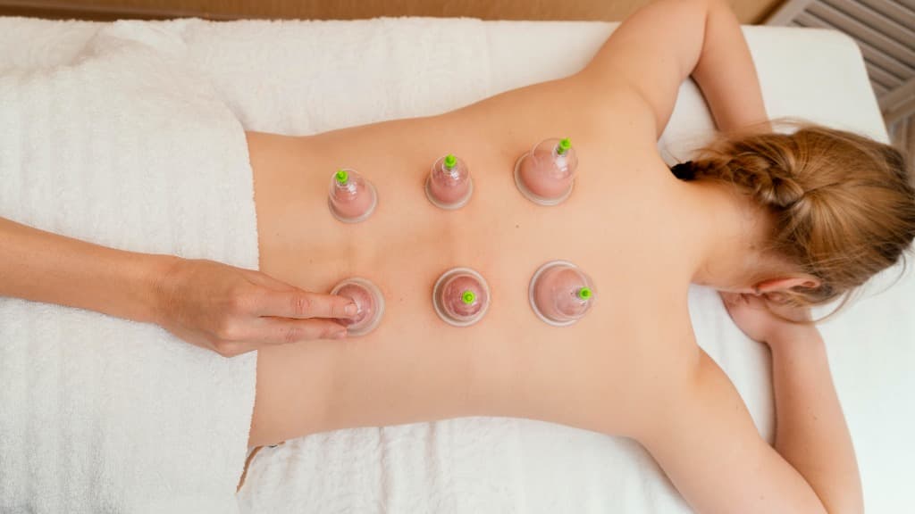 Cupping Therapy Treatment